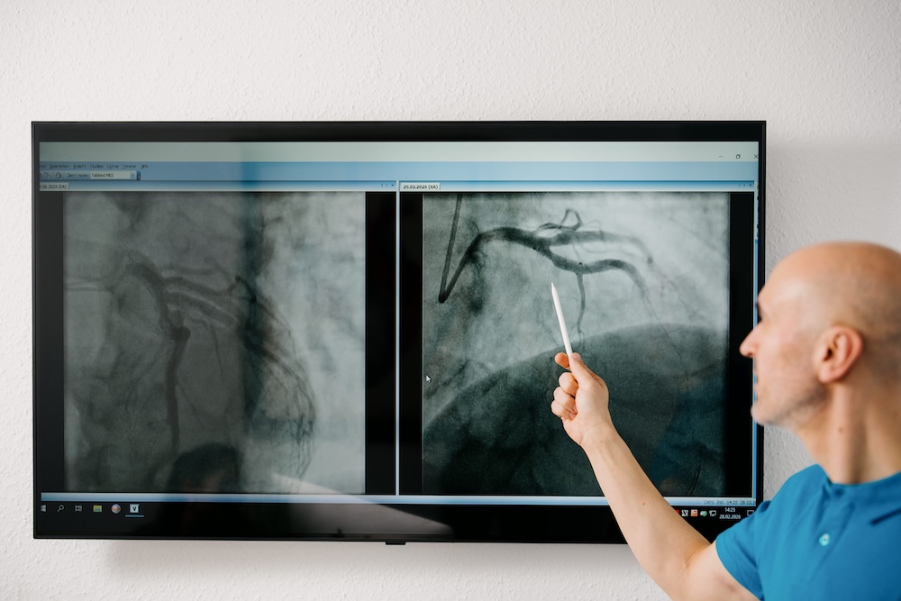hausarzt-wiesbaden-kardiologie-interventionelle-kardiologie-wiesbaden