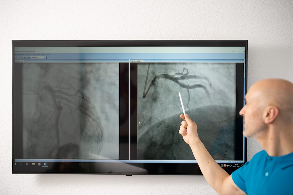 hausarzt-wiesbaden-kardiologie-herzklappenerkrankungen