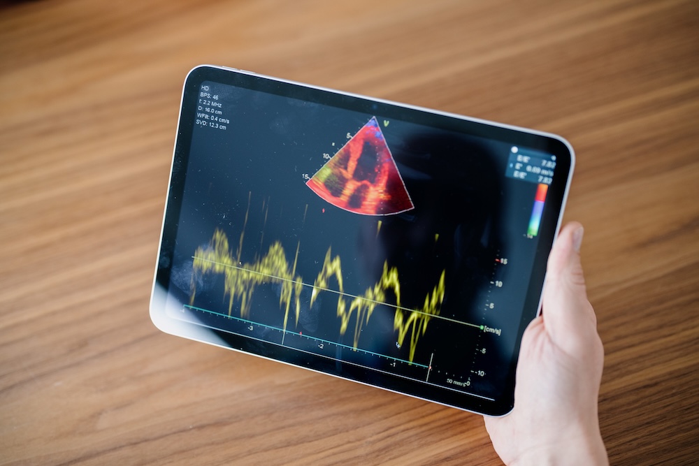 hausarzt-wiesbaden-kardiologie-Echokardiographie