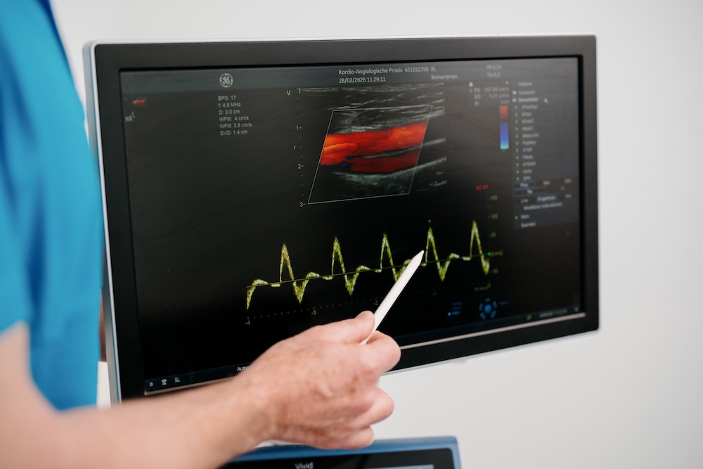 hausarzt-wiesbaden-kardiologie- leistungsseite-angiologie-untersuchung