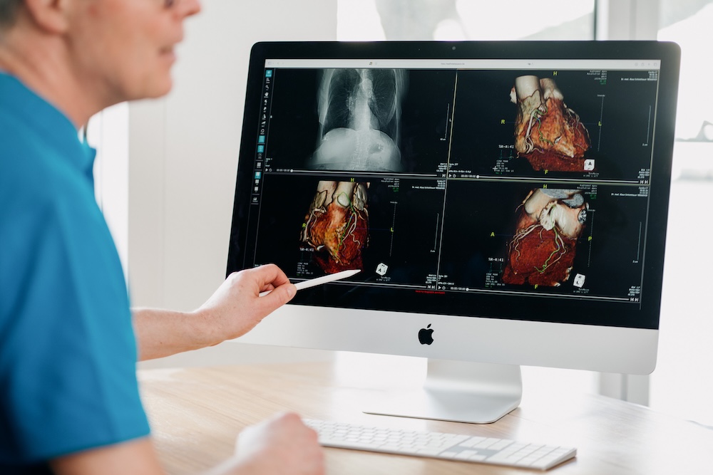 hausarzt-wiesbaden-kardiologie- leistungsseite-kardiologie---kardio-mrt